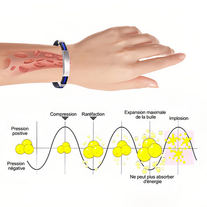(🔥DERNIER JOUR – 80 % DE RÉDUCTION🔥)丨Therapeutic Lympunclog Titanium Wristband — Inspiré par TitaniumION pour un usage quotidien, il soutient la circulation sanguine, la relaxation et soulage les inconforts articulaires.