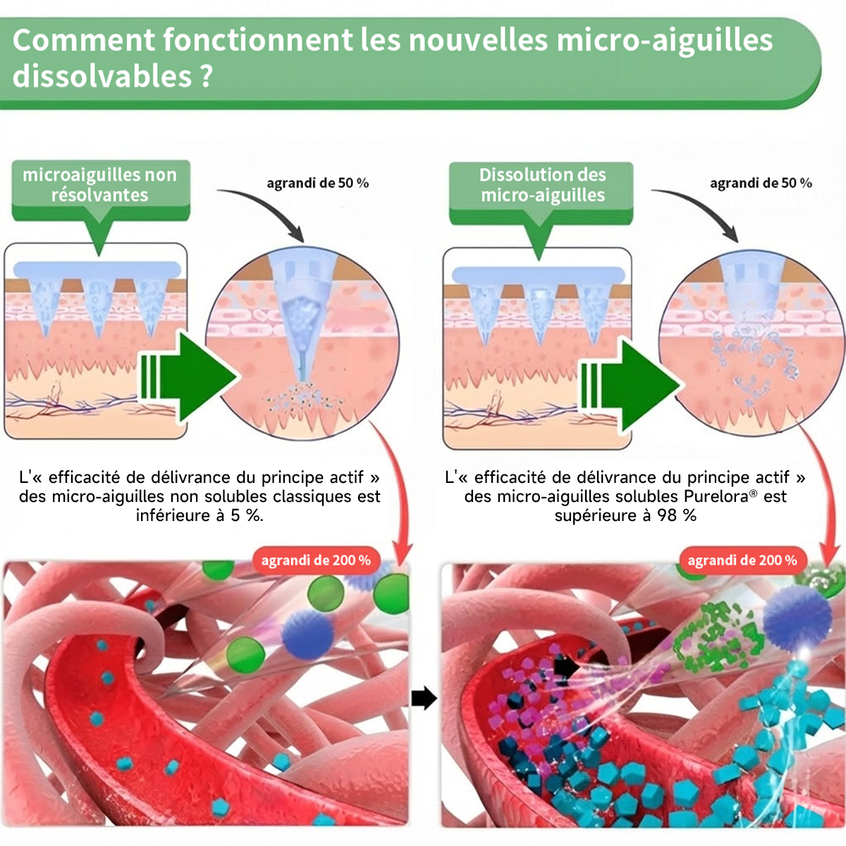 🔥 Nouveauté | Patch nano-micro-aiguilles Purelora® à la berbérine, au vinaigre de cidre de pomme et à l’EGCG 10-en-1 : brûle les graisses tenaces • lisse les rides • favorise le confort articulaire. Chaque patch agit — résultats visibles dès 7 jours.