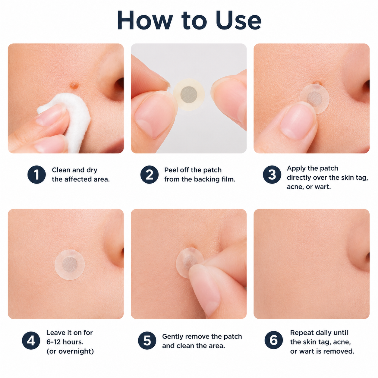 ✨Curalona® Patch micro-aiguilles et hydrocolloïde 2 en 1🍀 | Élimine les grains de beauté en relief, l'acné, les verrues planes et les acrochordons | Atténue les rides, les cicatrices et les imperfections |. Patchs invisibles pour le visage et le corps