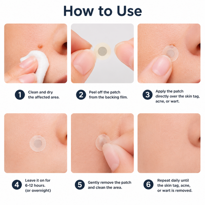 ✨Curalona® Patch micro-aiguilles et hydrocolloïde 2 en 1🍀 | Élimine les grains de beauté en relief, l'acné, les verrues planes et les acrochordons | Atténue les rides, les cicatrices et les imperfections |. Patchs invisibles pour le visage et le corps