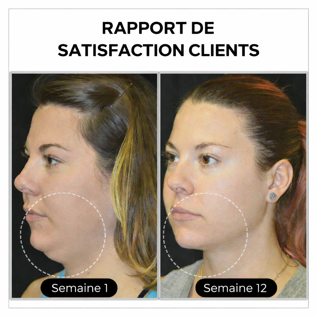 (🔥DERNIER JOUR DE PROMO - 80 % DE RÉDUCTION🔥) 🎉 Czticle® Histone Magnetology Lymphvity Boucles d’Oreilles en Germanium