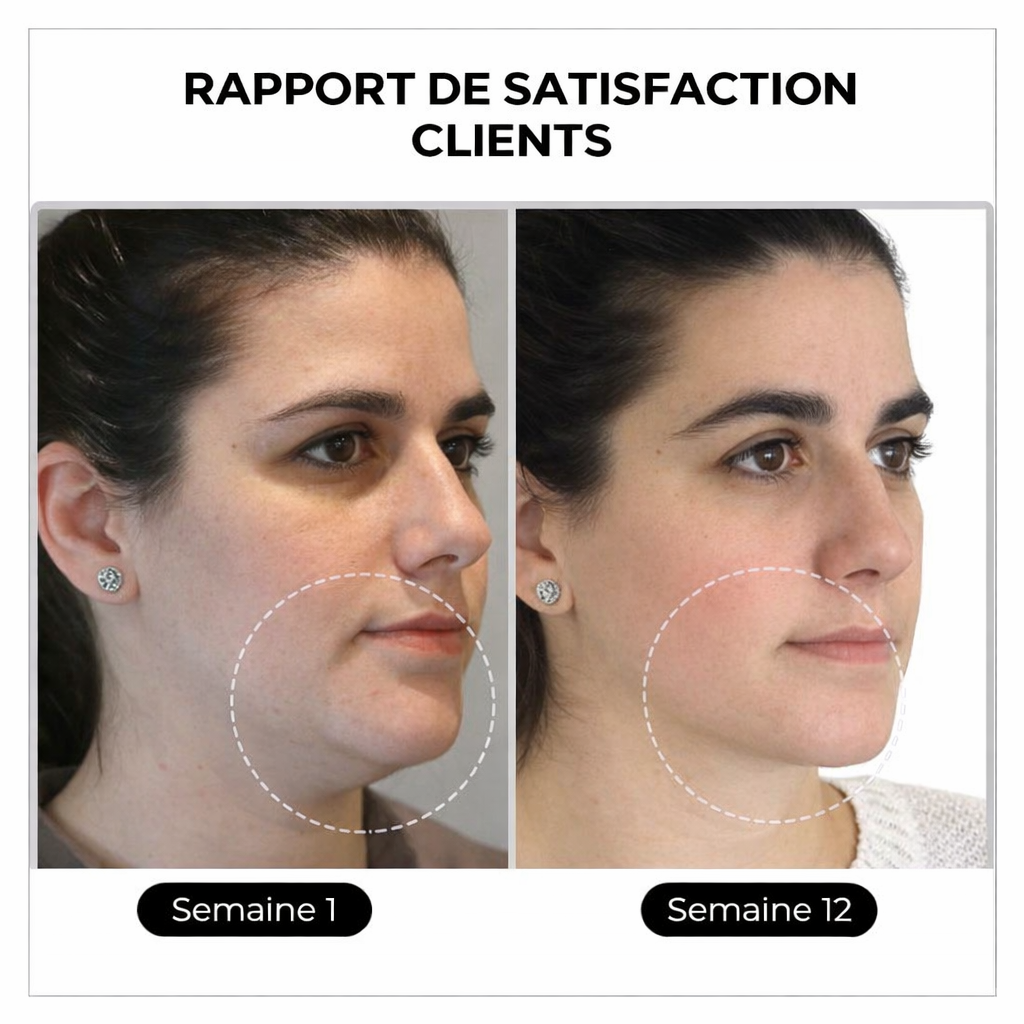 (🔥DERNIER JOUR DE PROMO - 80 % DE RÉDUCTION🔥) 🎉 Czticle® Histone Magnetology Lymphvity Boucles d’Oreilles en Germanium