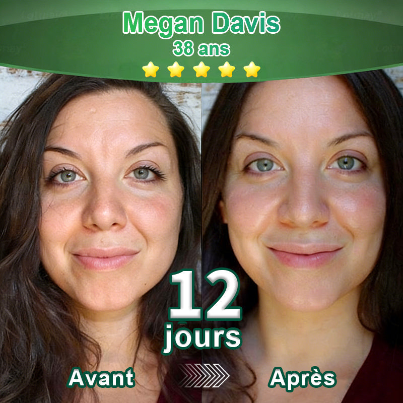 💖 Changez de l’intérieur vers l’extérieur | ✨ Purelora® Sérum Activateur EGF & Peptides de Cuivre dérivés de cellules souches (Active intensément le renouvellement cutané pour une peau plus ferme et plus lisse)