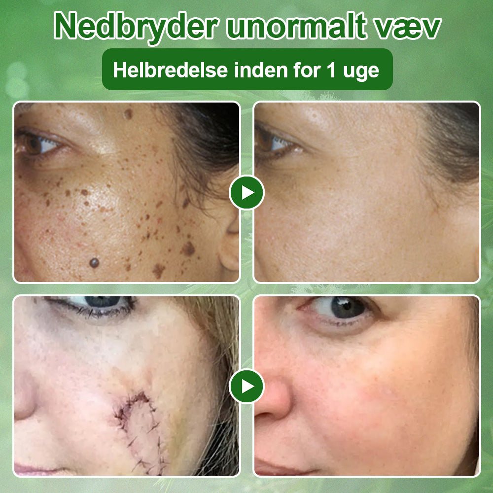 ✅Crème de soin Celsiora® à l'huile d'arbre à thé : élimine les imperfections, répare la peau abîmée, illumine le teint et offre une action anti-âge ❤️‍🔥