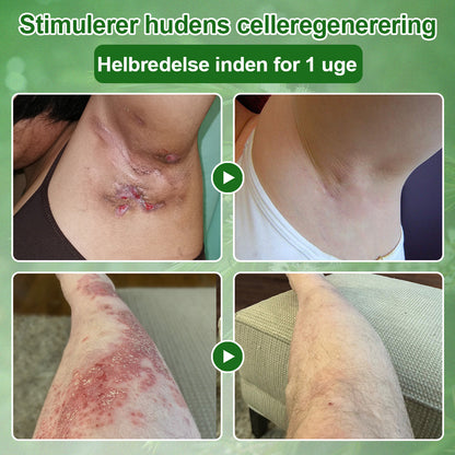 ✅Crème de soin Celsiora® à l'huile d'arbre à thé : élimine les imperfections, répare la peau abîmée, illumine le teint et offre une action anti-âge ❤️‍🔥