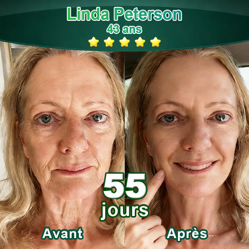 💖 Changez de l’intérieur vers l’extérieur | ✨ Purelora® Sérum Activateur EGF & Peptides de Cuivre dérivés de cellules souches (Active intensément le renouvellement cutané pour une peau plus ferme et plus lisse)